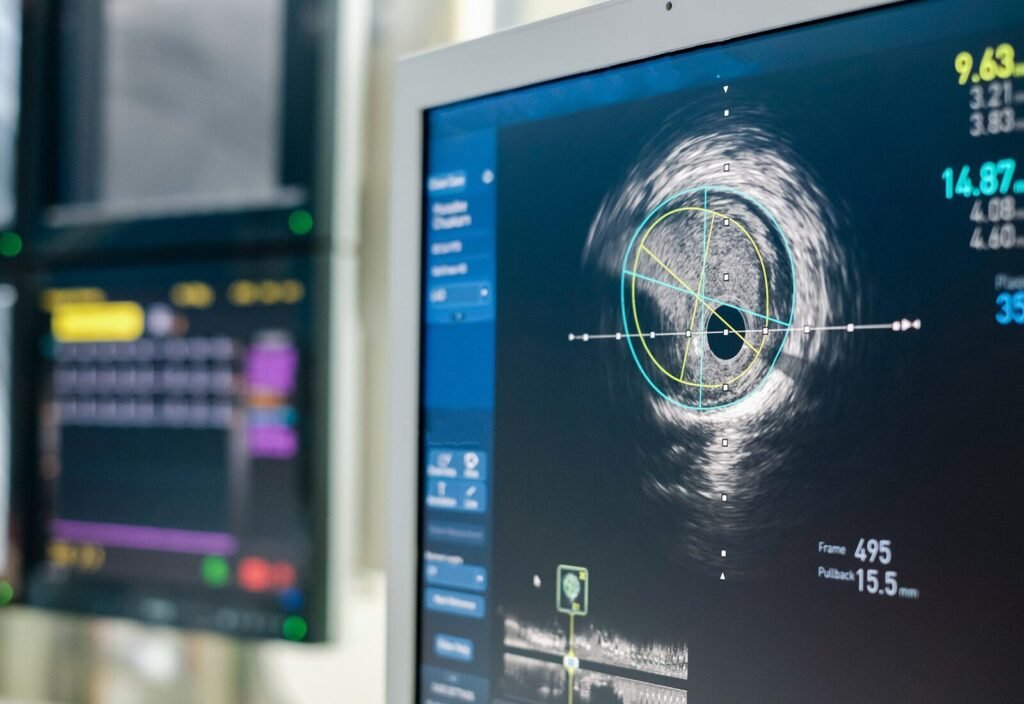IVUS, pencitraan dari dalam pembuluh darah